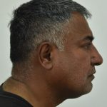 03032023dimposiopoihshaea4.2
