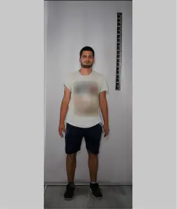 Φωτογραφία